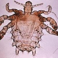 275px-Pthius_pubis_-_crab_louse_1.jpg