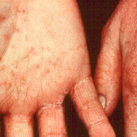 derm133_1.gif